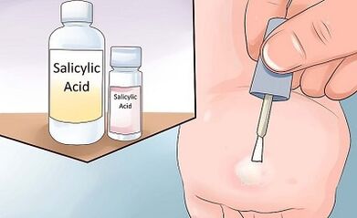 How to get rid of Folk Mode Papiloma
