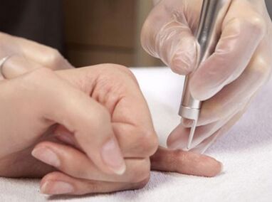 Implementation of laser therapy